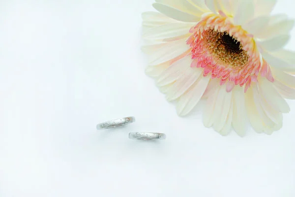 結婚指輪が抜けない原因は何か？対策と解決法を徹底解